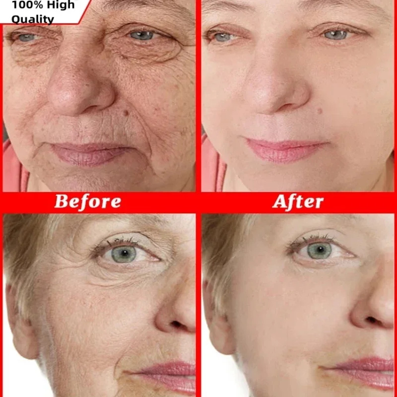 Instant Wrinkle Remover Gezich - Beauty Glazed Makeup recensie en prijs